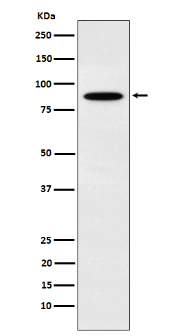 1 - Anti-EWSR1 Rabbit Monoclonal Antibody ABO15623