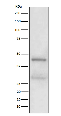 1 - Anti-MBD2 Rabbit Monoclonal Antibody ABO15625