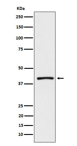 1 - Anti-ATP1B3 Rabbit Monoclonal Antibody ABO15630