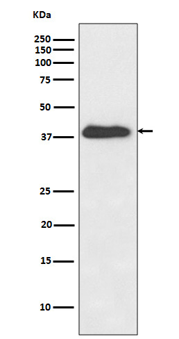 1 - Anti-XLF Rabbit Monoclonal Antibody ABO15631