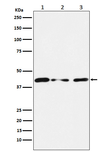 1 - Anti-Tin2 Rabbit Monoclonal Antibody ABO15634