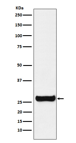 1 - Anti-GSTM1 Rabbit Monoclonal Antibody ABO15635