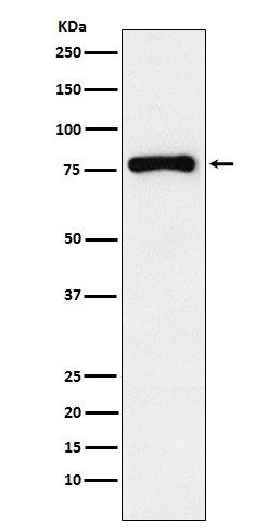 1 - Anti-RNase L Rabbit Monoclonal Antibody ABO15638