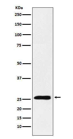 1 - Anti-TNFSF9 Rabbit Monoclonal Antibody ABO15639