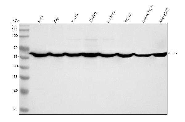 1 - Anti-TCP1 beta Rabbit Monoclonal Antibody ABO15640