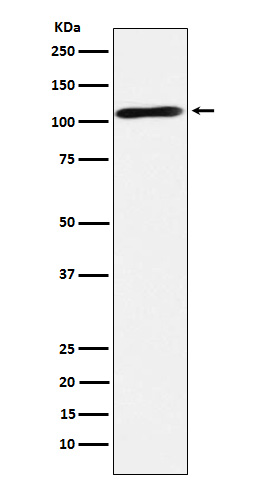 1 - Anti-Epac2 Rabbit Monoclonal Antibody ABO15641