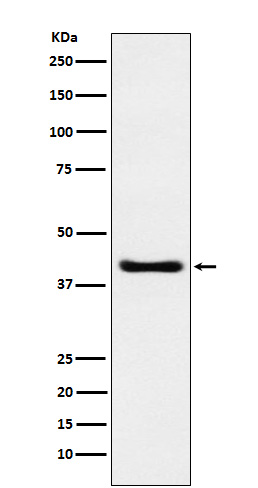 1 - Anti-SPOP Rabbit Monoclonal Antibody ABO15642