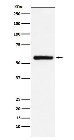 1 - Anti-STK33 Rabbit Monoclonal Antibody ABO15645