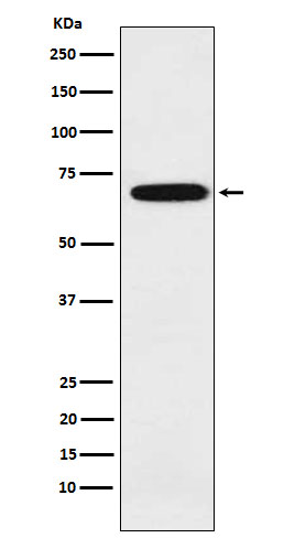 1 - Anti-IKZF3 Rabbit Monoclonal Antibody ABO15646