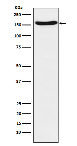 1 - Anti-FANCA Rabbit Monoclonal Antibody ABO15651