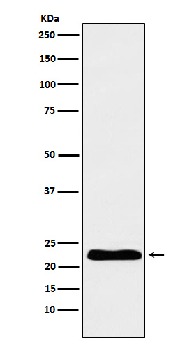 1 - Anti-TNNI1 Rabbit Monoclonal Antibody ABO15652