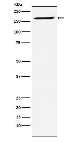 1 - Anti-SMC4 Rabbit Monoclonal Antibody ABO15654