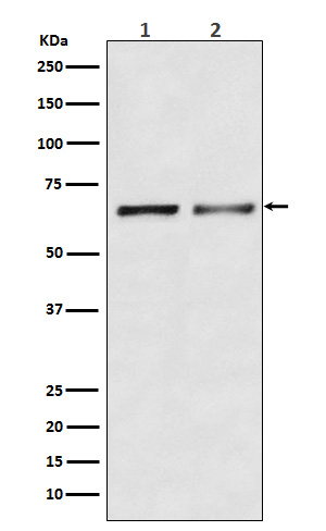 1 - Anti-Activin Receptor Type IIB/ACVR2B Rabbit Monoclonal Antibody ABO15655