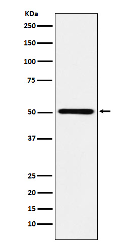 1 - Anti-RING1 Rabbit Monoclonal Antibody ABO15657