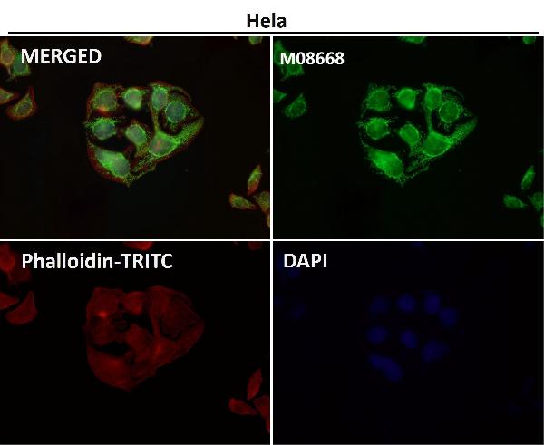 1 - Anti-TOMM22/TOM22 Rabbit Monoclonal Antibody ABO15659