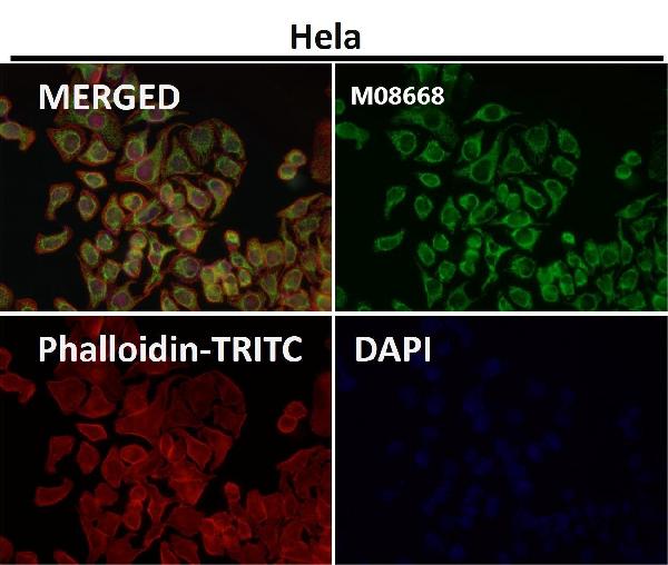 1 - Anti-TOMM22/TOM22 Rabbit Monoclonal Antibody ABO15659