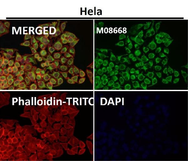 1 - Anti-TOMM22/TOM22 Rabbit Monoclonal Antibody ABO15659