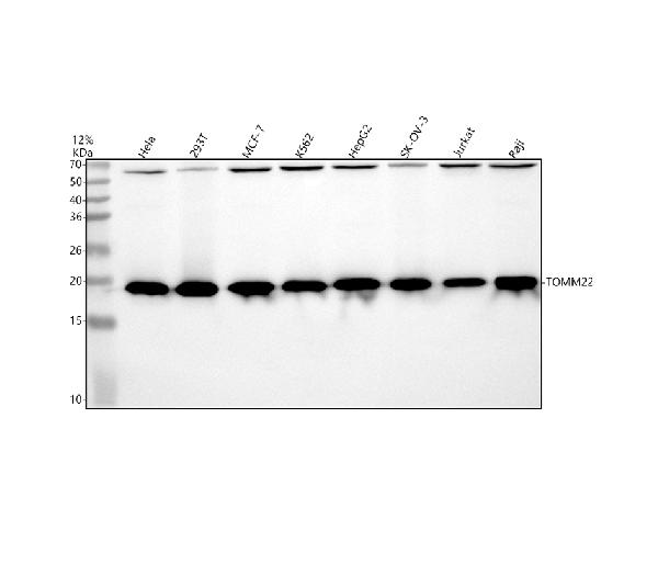1 - Anti-TOMM22/TOM22 Rabbit Monoclonal Antibody ABO15659