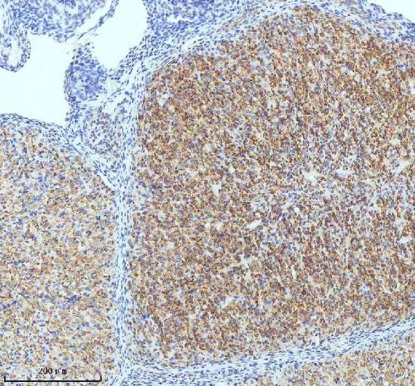 2 - Anti-Oxytocin Receptor Rabbit Monoclonal Antibody ABO15661