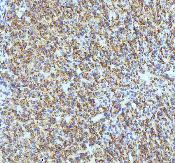 2 - Anti-Oxytocin Receptor Rabbit Monoclonal Antibody ABO15661