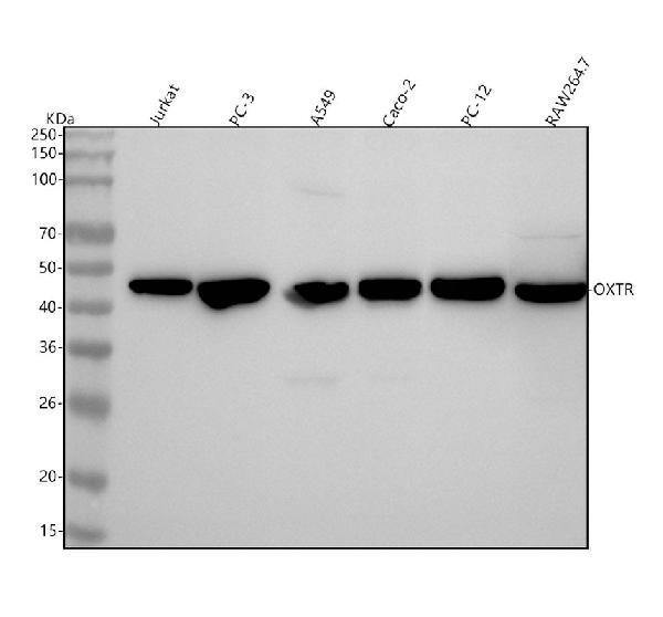 1 - Anti-Oxytocin Receptor Rabbit Monoclonal Antibody ABO15661