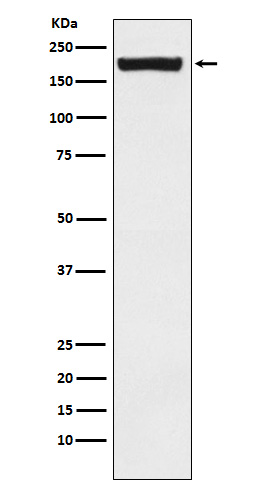 1 - Anti-MRC2/ENDO180 Rabbit Monoclonal Antibody ABO15662