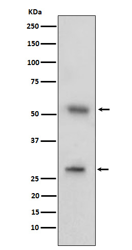 1 - Anti-CD97 Rabbit Monoclonal Antibody ABO15663