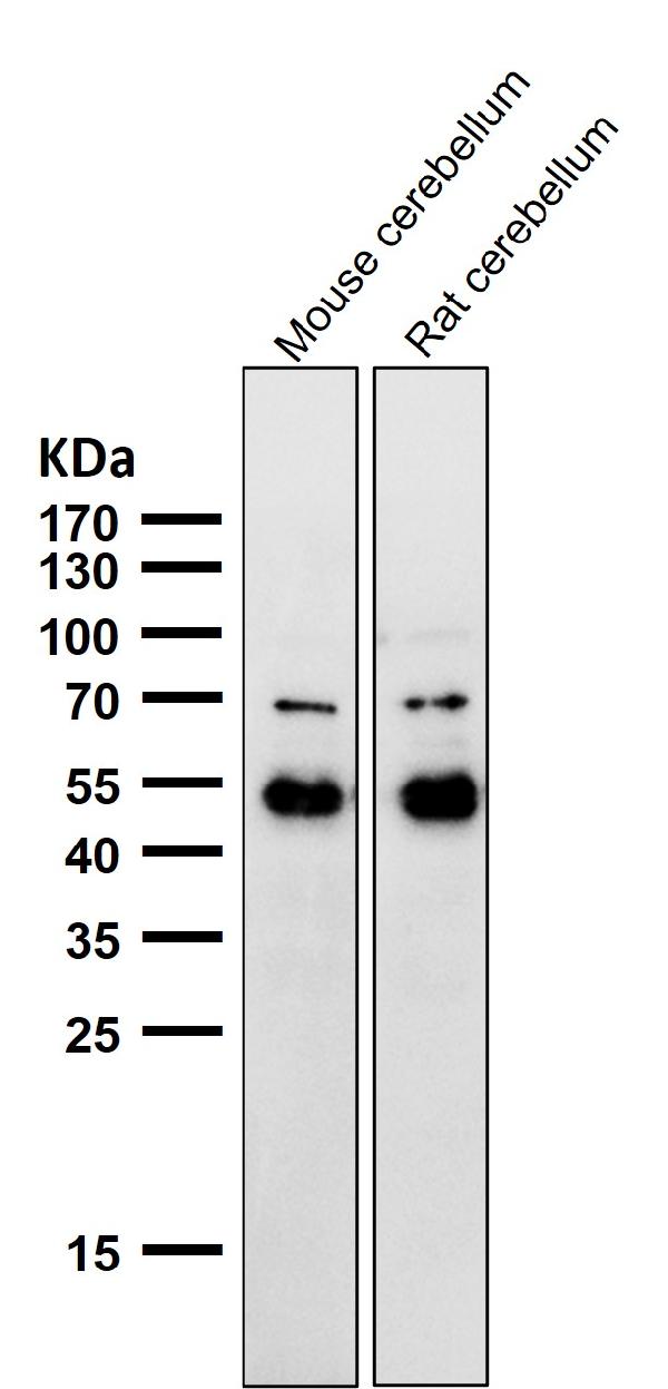 1 - Anti-NeuroD2 Rabbit Monoclonal Antibody ABO15664