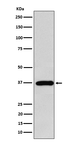 1 - Anti-FBP1 Rabbit Monoclonal Antibody ABO15666