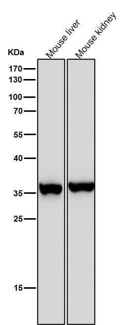 1 - Anti-FBP1 Rabbit Monoclonal Antibody ABO15666