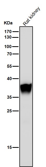1 - Anti-FBP1 Rabbit Monoclonal Antibody ABO15666