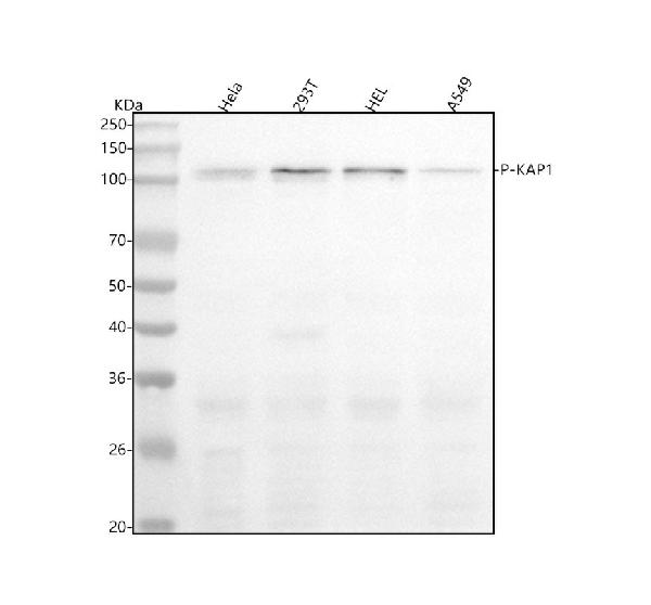 1 - Anti-Phospho-KAP1 (S824) Rabbit Monoclonal Antibody ABO15668