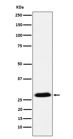 1 - Anti-GSC Rabbit Monoclonal Antibody ABO15671