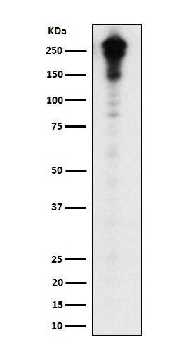 1 - Anti-Desmoplakin Rabbit Monoclonal Antibody ABO15673