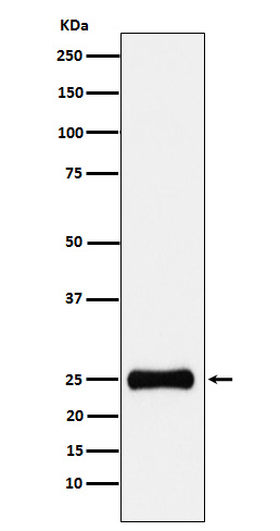 1 - Anti-PSMA2 Rabbit Monoclonal Antibody ABO15675