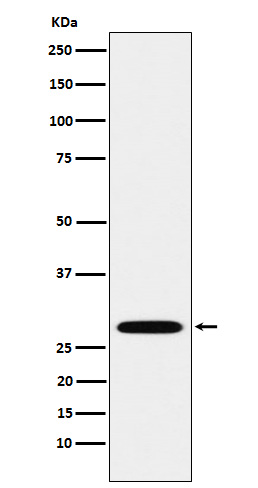 1 - Anti-PSMA3 Rabbit Monoclonal Antibody ABO15676