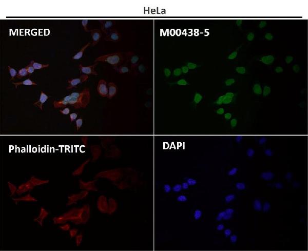 1 - Anti-Lamin A/C Rabbit Monoclonal Antibody ABO15677