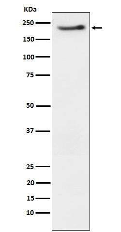 1 - Anti-Phospho-ErbB3 (Y1222) Rabbit Monoclonal Antibody ABO15684