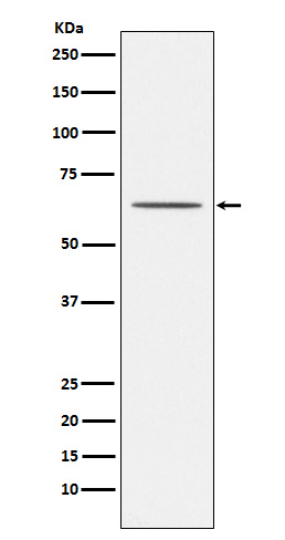 1 - Anti-Nogo Receptor Rabbit Monoclonal Antibody ABO15689