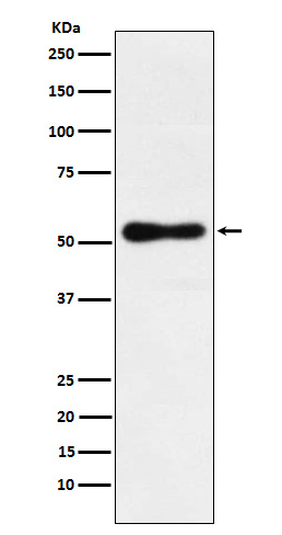 1 - Anti-ROR beta Rabbit Monoclonal Antibody ABO15690
