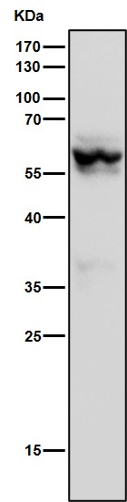 1 - Anti-ROR beta Rabbit Monoclonal Antibody ABO15690