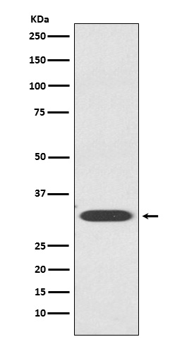 1 - Anti-IGFBP1 Rabbit Monoclonal Antibody ABO15692