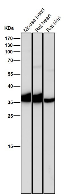 1 - Anti-IGFBP1 Rabbit Monoclonal Antibody ABO15692