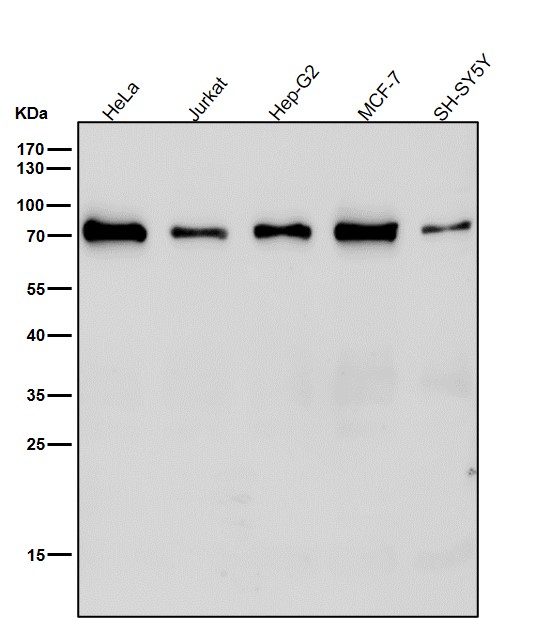 1 - Anti-IL7R alpha/CD127 Rabbit Monoclonal Antibody ABO15695
