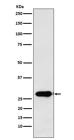 1 - Anti-Calpain S1 Rabbit Monoclonal Antibody ABO15698
