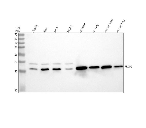 1 - Anti-Peroxiredoxin 5 Rabbit Monoclonal Antibody ABO15699