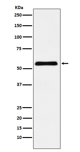 1 - Anti-CBX2 Rabbit Monoclonal Antibody ABO15700