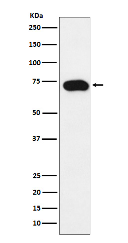 1 - Anti-SLC22A1 Rabbit Monoclonal Antibody ABO15701