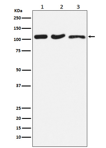 1 - Anti-DISC1 Rabbit Monoclonal Antibody ABO15703
