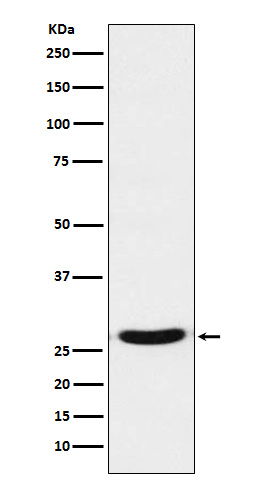1 - Anti-TCF21 Rabbit Monoclonal Antibody ABO15704